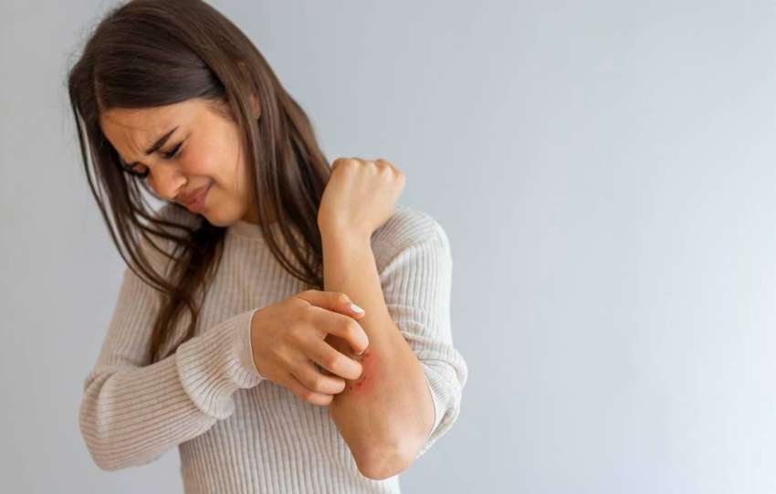3 Easy ways to get rid of eczema
