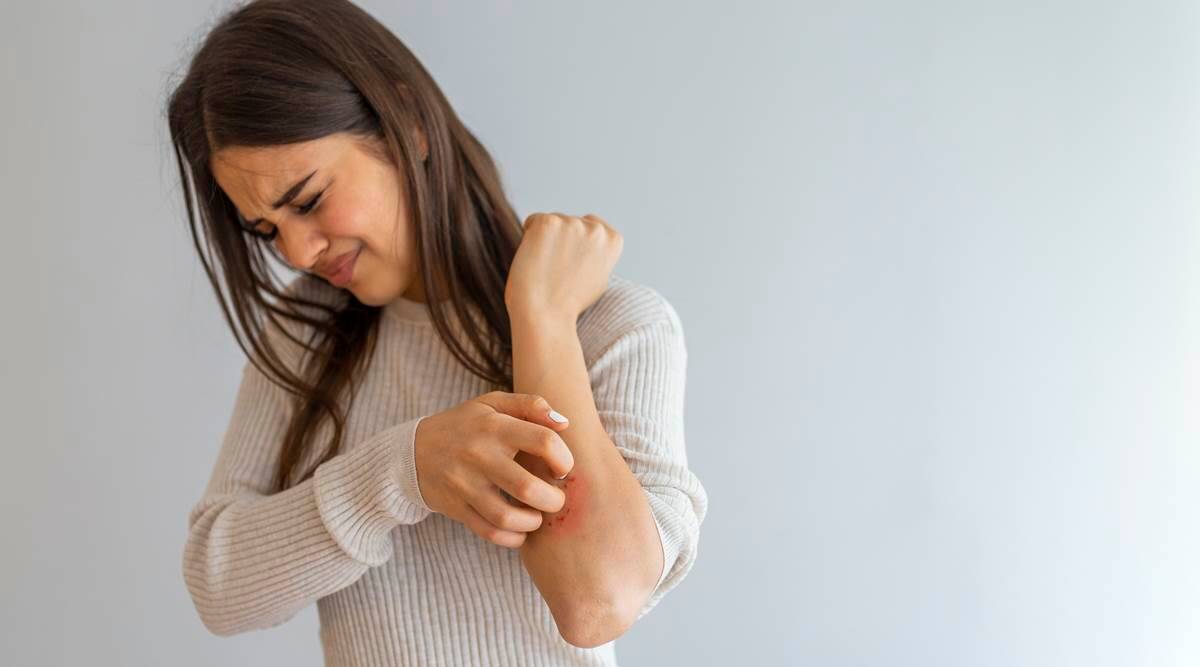 3 Easy ways to get rid of eczema