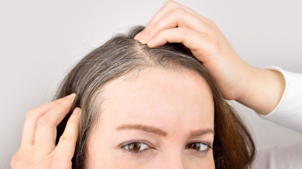 Diseases That Cause Alopecia Or Hair Loss