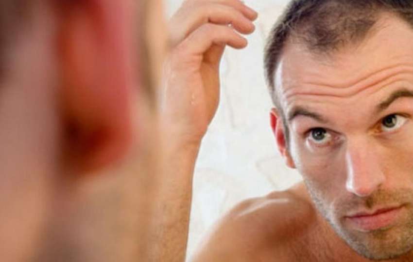 Why do men experience hair loss in the rainy season?