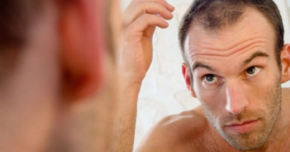 Why do men experience hair loss in the rainy season?