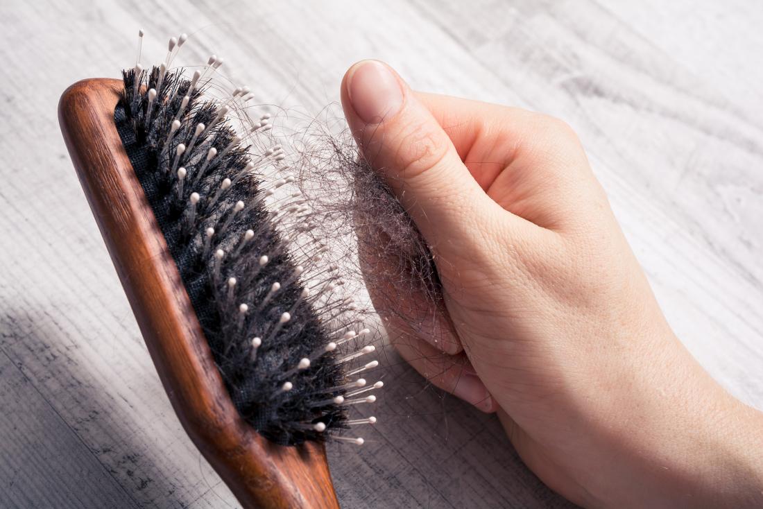 Hair fall in women: Causes, Symptoms & Treatment