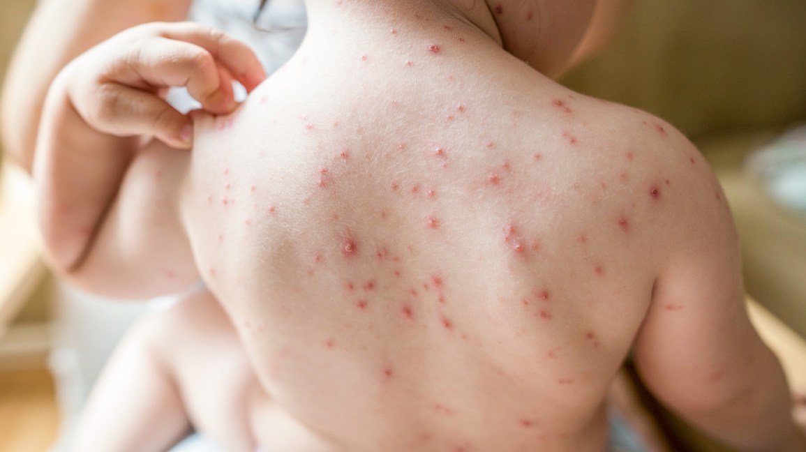When To See A Skin Doctor For Skin Allergy