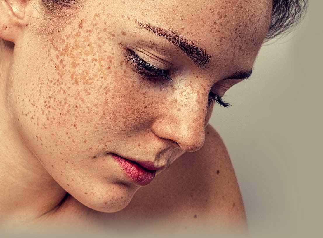 How A Skin Doctor Treats Skin Pigmentation