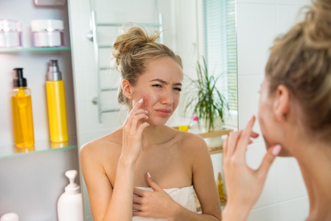 How To Choose A Good Acne Treatment