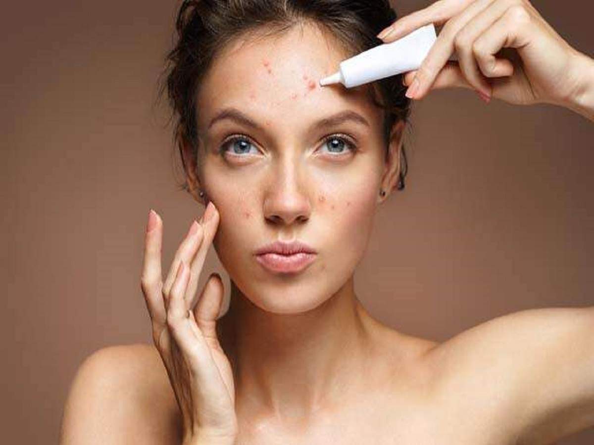 How To Get Rid Of acne without chemicals